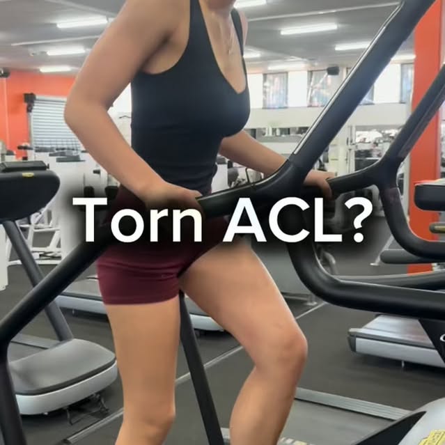 #adamphysiocairns #physiocairns #acl #aclsurgery #aclrecovery